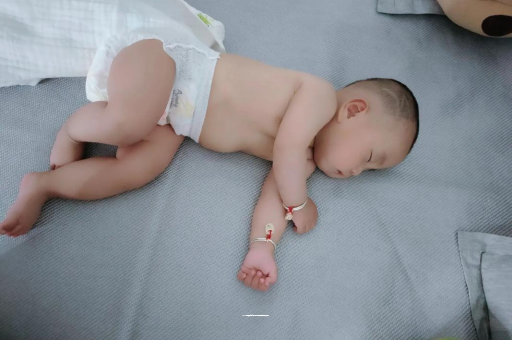 安顺六个月宝宝眼睛散光